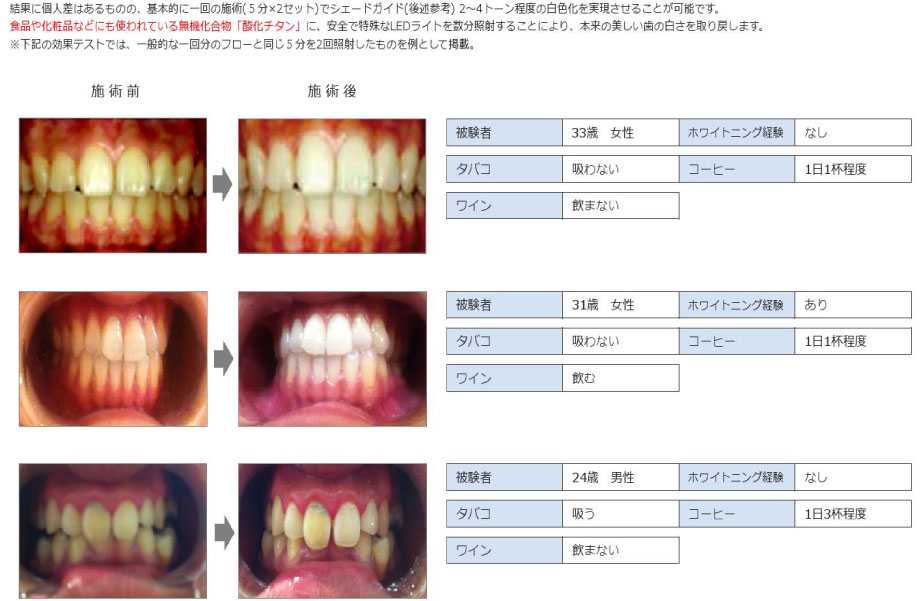 歯のセルフホワイトニングサービス 灰吹屋薬局